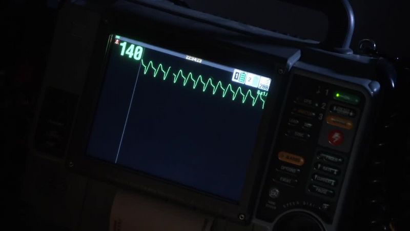 She's in cardiac arrest