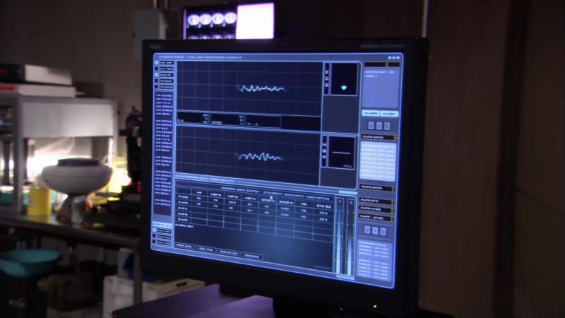 She's in VFIB. Code blue!