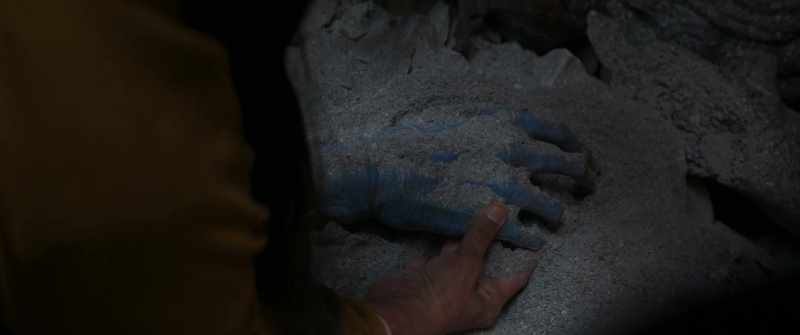 Should we be concerned it's on a severed arm?