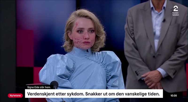 Signe, you would like