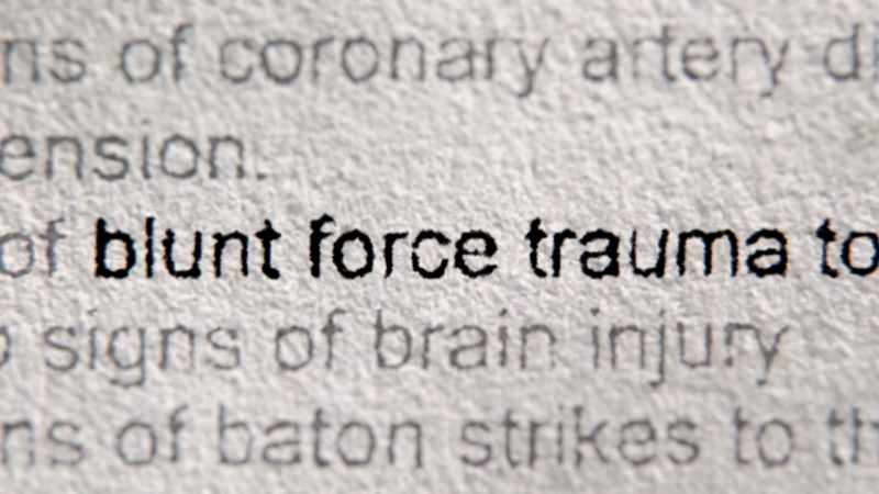 Signs of blunt force trauma