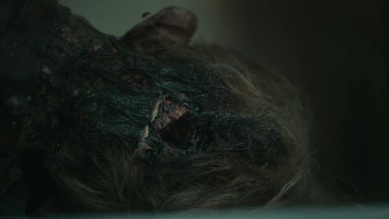 Single blow to the back of the head