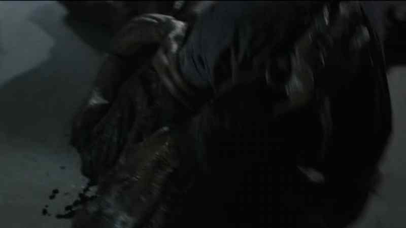 [ Skitter wheezes ]