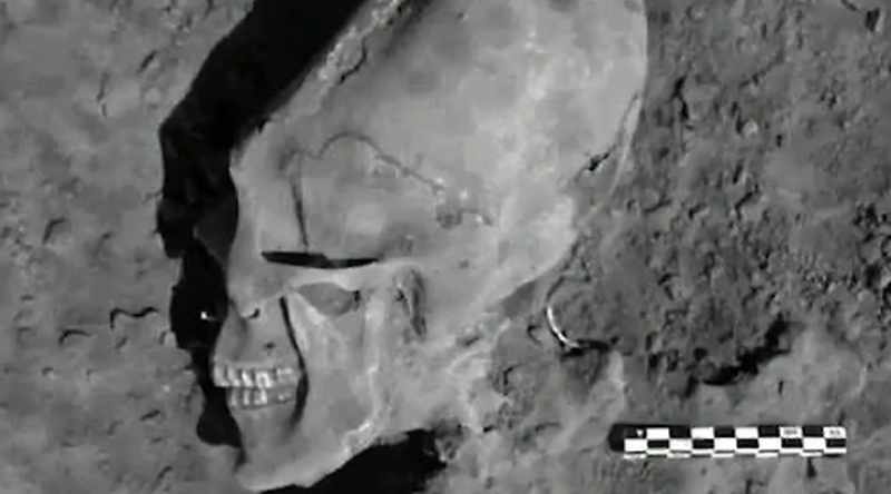 Skull elongation is this strange activity
