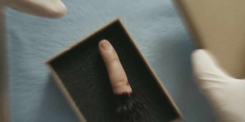 Small hesitation cut on Nicky's finger
