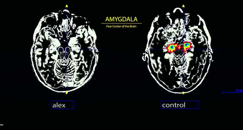So an interesting thing, do you have no activation in your amygdala?
