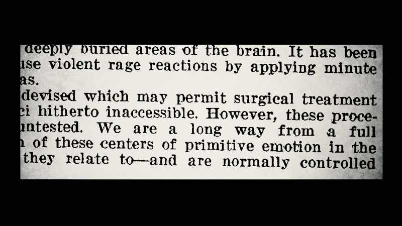 So was any trace of reference to psychosurgery