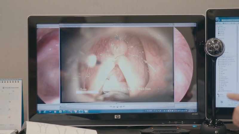 So we change your vocal cord more shorter, thinner and tighter