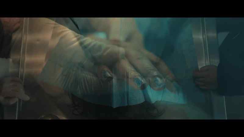 So, clearly, we have discoloration throughout the hand