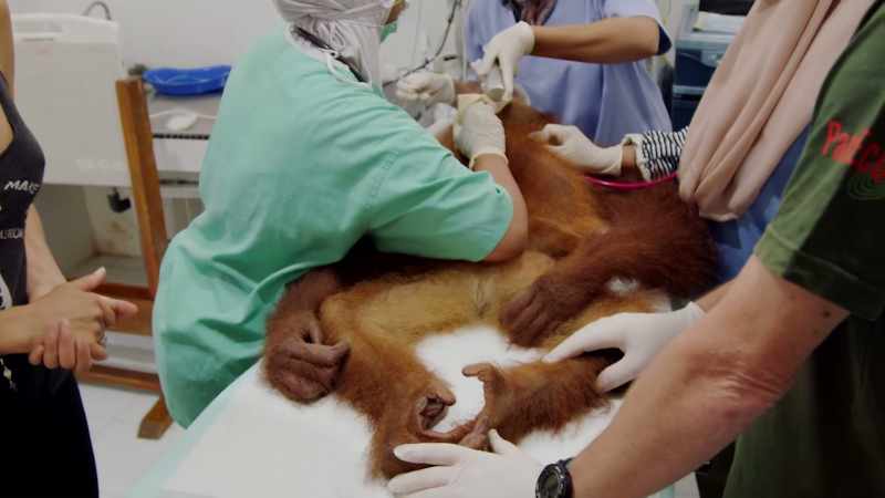 So, they get chest x-rays to check for TBC