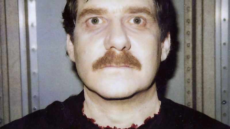 So it was just a neck prosthetic