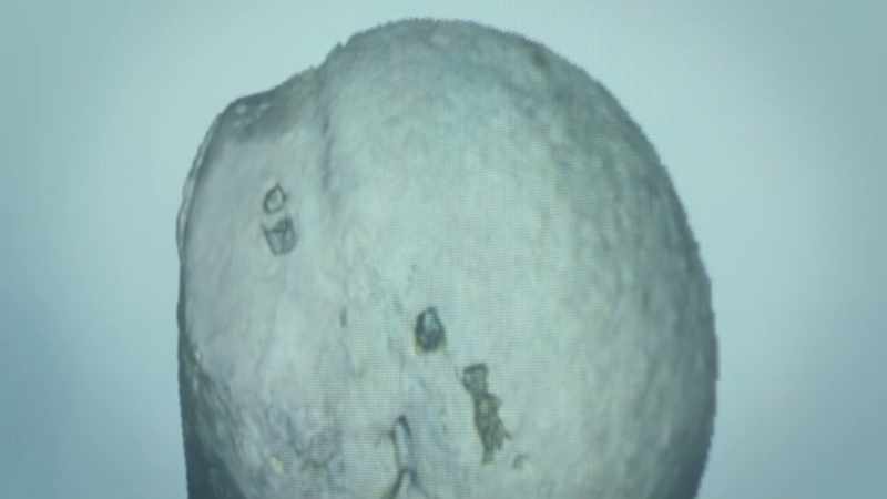 So it's being pulled or possibly even ripped in this area