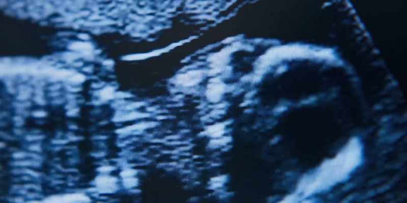 So, the placenta looks nice and healthy