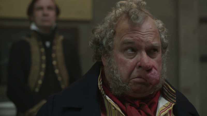So, the procedure that I propose is a tracheotomy