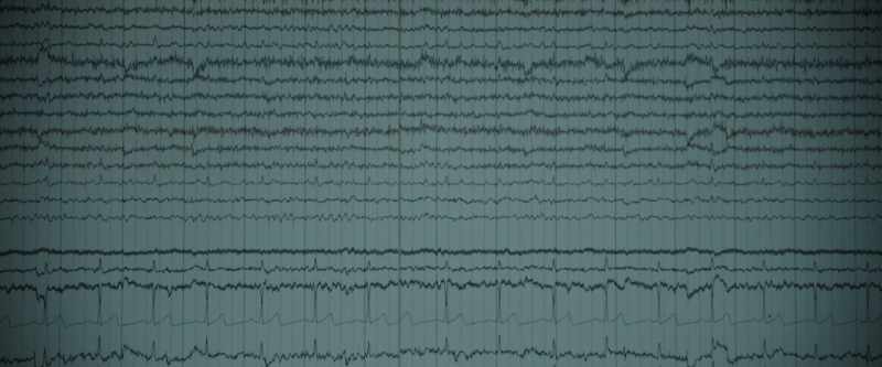 So we went and applied an EEG to see