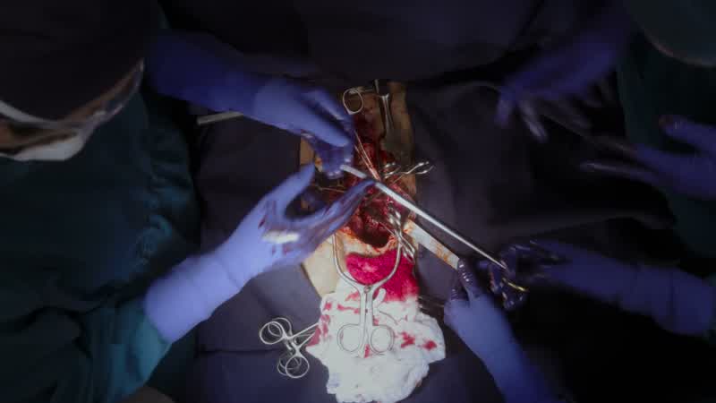 DR. REZNICK: So, what'’d you get?