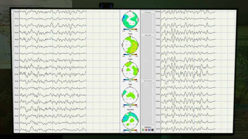 So when you read the EEG