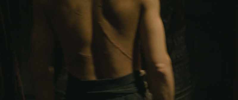 Some battle scars, but many are from his spies