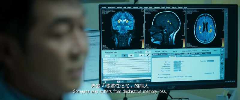 Someone who suffers from declarative memory loss