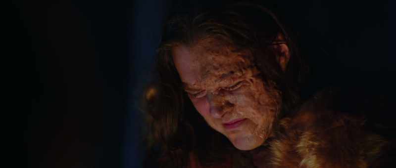Sometimes I wake up feeling like my skin's on fire