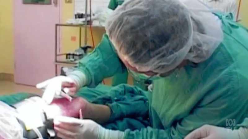 Sometimes, severely burnt patients just don't have enough