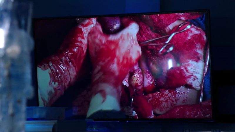 Spleen's coming out