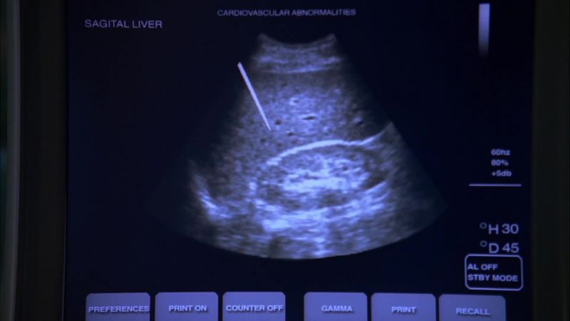 Stop the biopsy