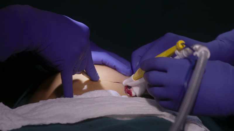 [ Suction hissing ]