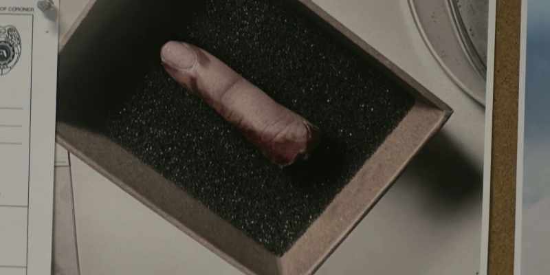 [Tanya] No, but the nub where his finger used to be