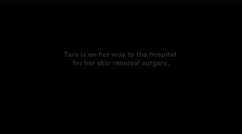Tara: [ Voice breaking ] IT'S A REALLY BIG SURGERY