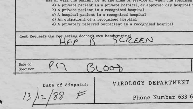 Testing was done for both HIV and for Hepatitis B prior to autopsy