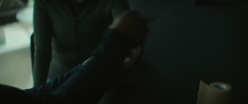 That doesn't look like normal bruising Sam
