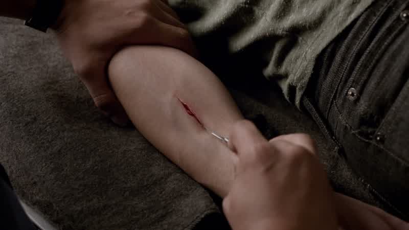 That looks like it healed really fast