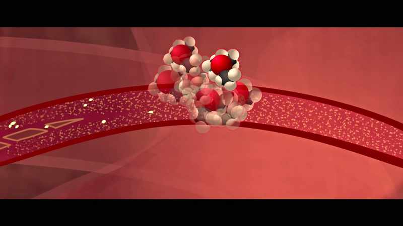 That molecule drives cholesterol into the artery walls