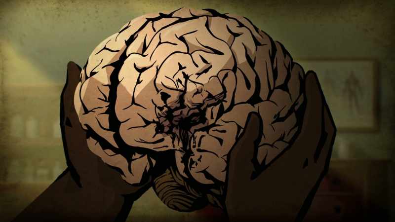 That part of our brain has been known ever since