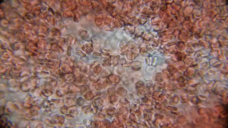 That is the DNA from a fetus