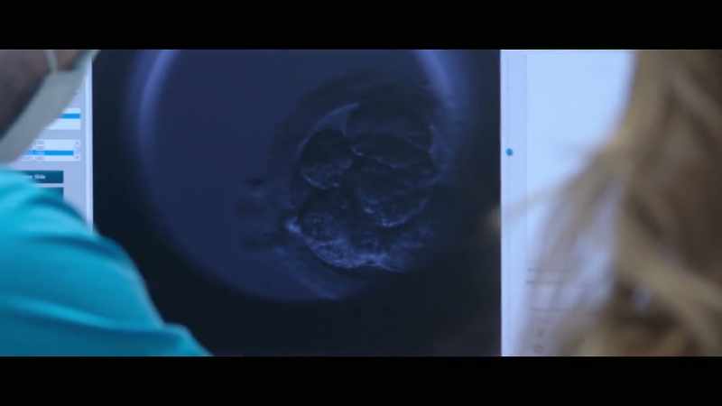 That's how it looked before we transferred him and biopted