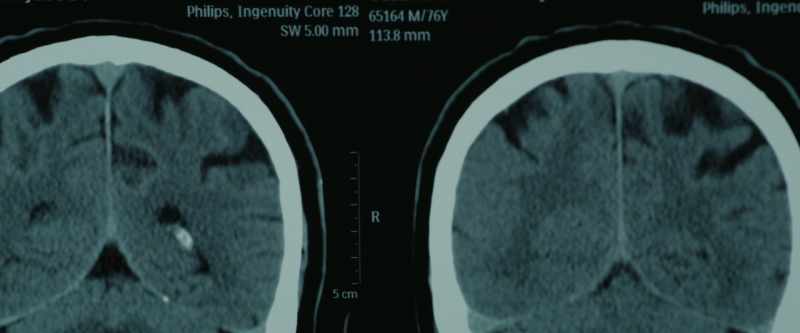 The brain is a prediction machine that is designed