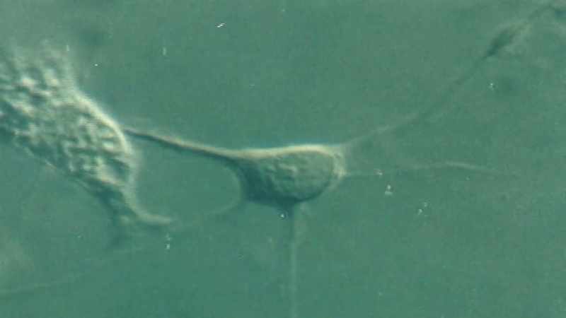 The destruction from an epidemic can have ripple effects