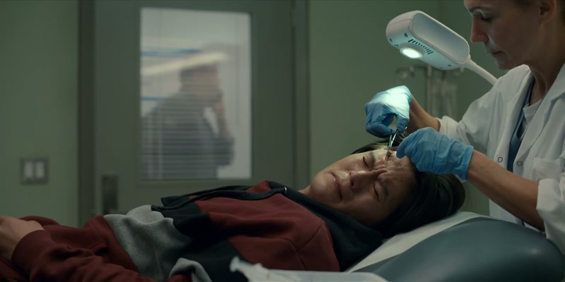 The doctor ordered a CT, but your brother's fine