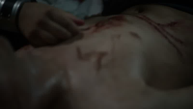 The grounders cauterized the wound
