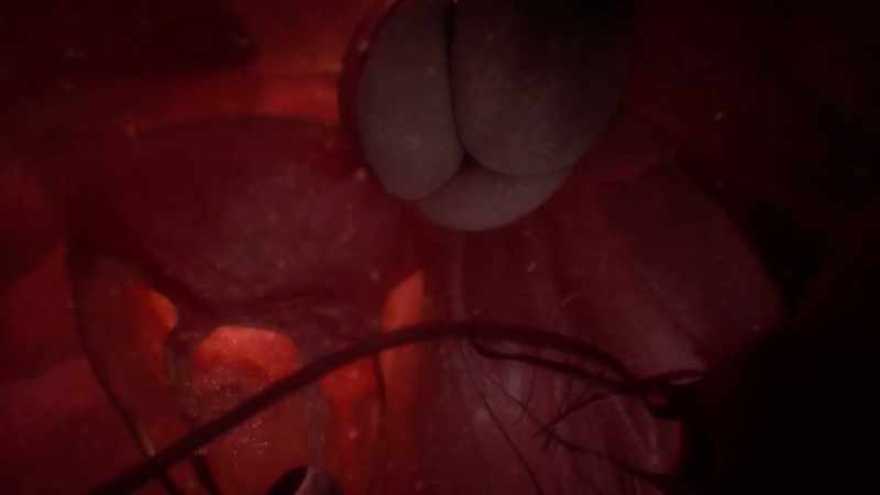 The heart itself is just two pumps