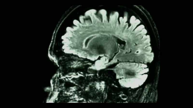 The higher the frequency of the brain