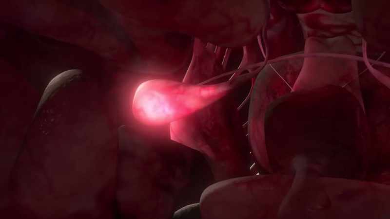 The impulses go straight to the amygdala