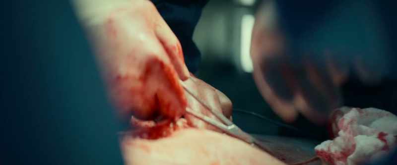 The internal organ will be repaired