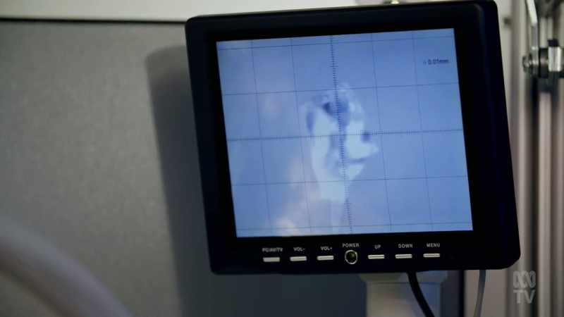 The invention was X-ray crystallography