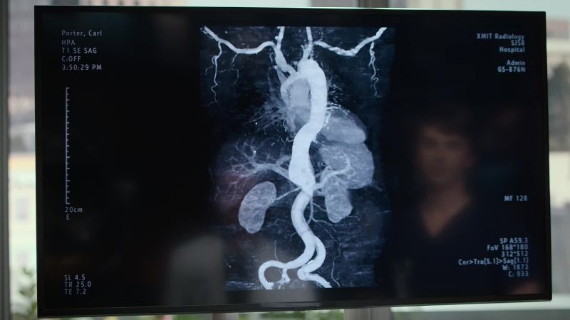 The liver is being damaged by a new aneurysm