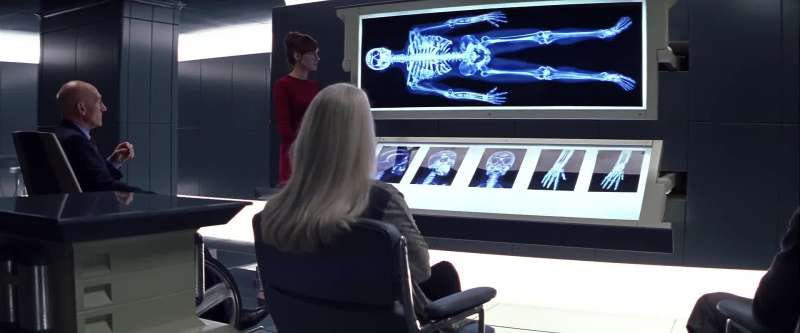 The metal is an alloy called adamantium