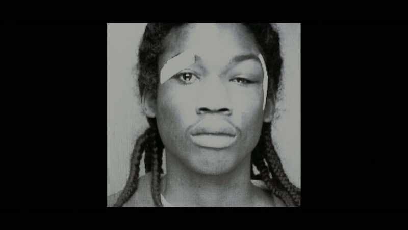 The multiple injuries Meek suffered