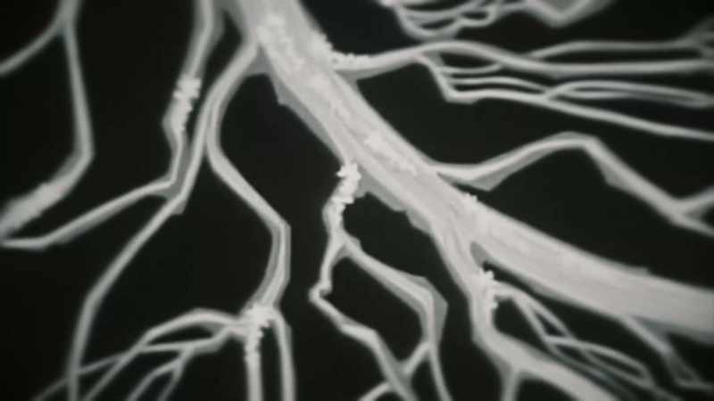 The new methodology of implanted electrodes has provided direct access